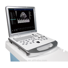 DW-C60PLUS 3D 4D doppler couleur machine à ultrasons pour les femmes avec bébé